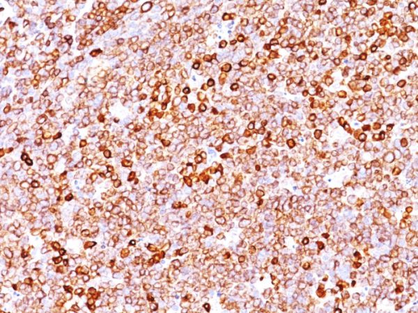 Formalin-fixed, paraffin-embedded human Tonsil stained with CD79a Rabbit Recombinant Monoclonal Antibody (IGA/1688R).
