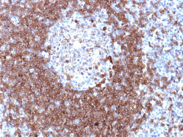 Formalin-fixed, paraffin-embedded human Tonsil stained with CD79a Rabbit Polyclonal Antibody.