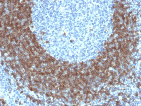 Formalin-fixed, paraffin-embedded human Tonsil stained with CD79b Mouse Monoclonal Antibody (IGB/1842).