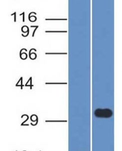 Western Blot Analysis (1) Human CD79b recombinant fragment and (2) Raji cell lysate using CD79b Mouse Monoclonal Antibody (IGB/1843).