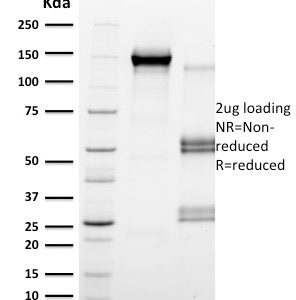SDS-PAGE Analysis  Purified CD79b Mouse Monoclonal Antibody (IGB/2555). Confirmation of Integrity and Purity of Antibody.