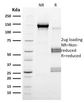 SDS-PAGE Analysis Purified CD79b Mouse Monoclonal Antibody (IGB/2555). Confirmation of Integrity and Purity of Antibody.