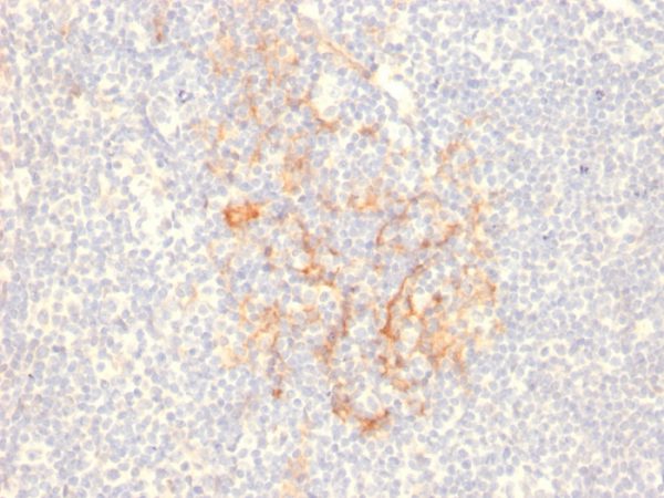 Formalin-fixed, paraffin-embedded human Tonsil stained with CD79b Mouse Monoclonal Antibody (IGB/2555).
