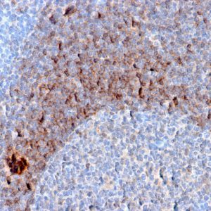Formalin-fixed, paraffin-embedded human Tonsil stained with CD79b Mouse Monoclonal Antibody (B29/123).