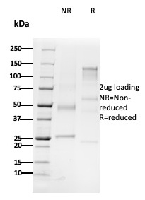SDS-PAGE Analysis Purified CD79b Mouse Monoclonal Antibody (B29/123). Confirmation of Purity and Integrity of Antibody.