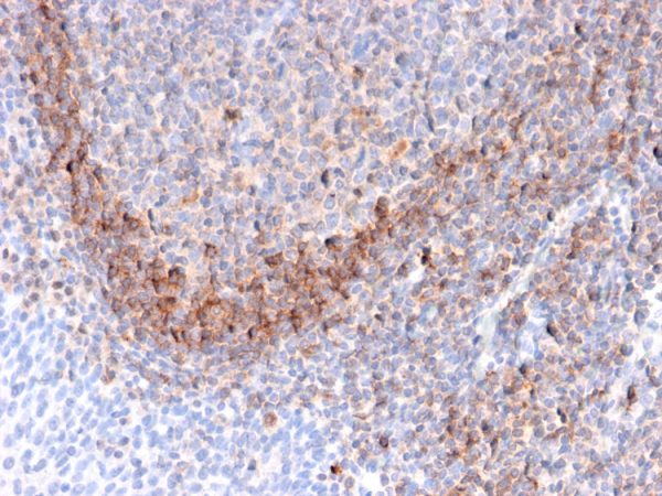 Formalin-fixed, paraffin-embedded human Tonsil stained with CD79b Mouse Monoclonal Antibody (B29/123).
