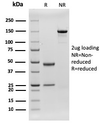 SDS-PAGE Analysis of Purified CD79b Recombinant Mouse Monoclonal Antibody (rIGB/1842). Confirmation of Integrity and Purity of Antibody.