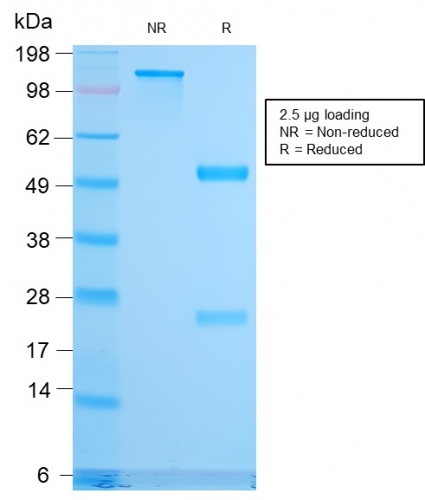 SDS-PAGE Analysis Purified CD79b Recombinant Rabbit Monoclonal Antibody (IGB/3170R). Confirmation of Purity and Integrity of Antibody.