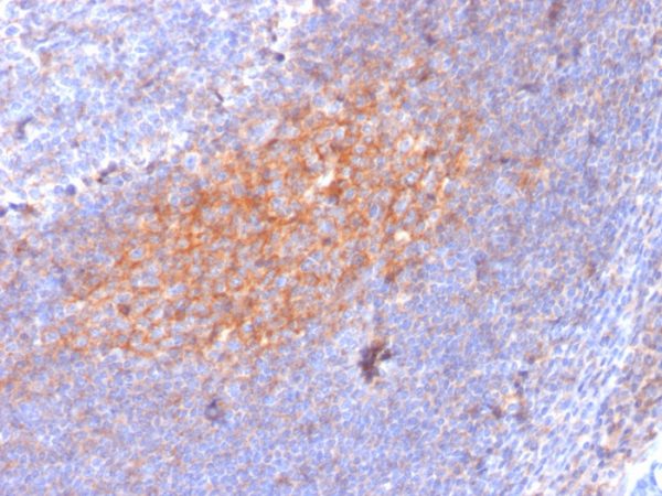Formalin-fixed, paraffin-embedded human Lymph Node stained with CD81 Mouse Monoclonal Antibody (1.3.3.22).