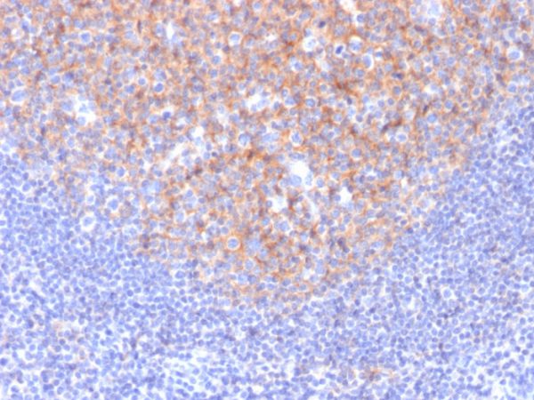 Formalin-fixed, paraffin-embedded human Tonsil stained with CD81 Mouse Monoclonal Antibody (1.3.3.22).