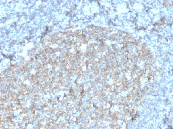 Formalin-fixed, paraffin-embedded human tonsil stained with CD81 Recombinant Mouse Monoclonal Antibody (rC81/3442).
