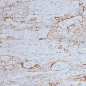 Formalin-fixed, paraffin-embedded human colon stained with CD151 Mouse Monoclonal Antibody (11G5a).