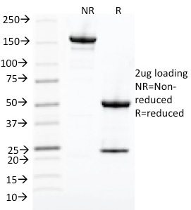 SDS-PAGE Analysis Purified Cdk1 Mouse Monoclonal Antibody (POH-1). Confirmation of Integrity and Purity of Antibody