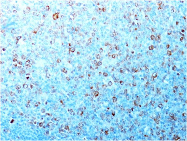 Formalin-fixed, paraffin-embedded human Tonsil stained with Cdk1 Mouse Monoclonal Antibody (CDK1/873).