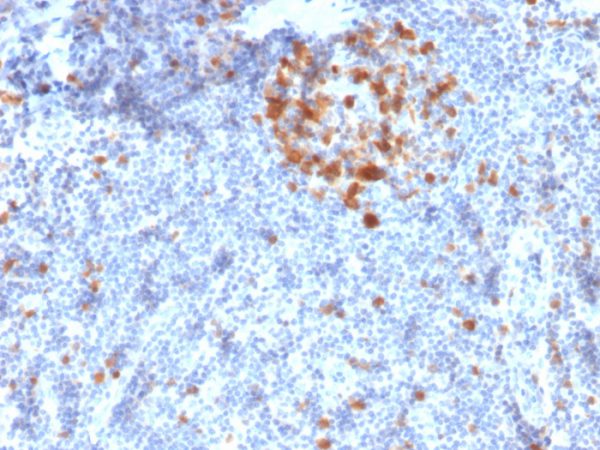 Formalin-fixed, paraffin-embedded human Tonsil stained with Cdk1 Mouse Monoclonal Antibody (A17.1.1).