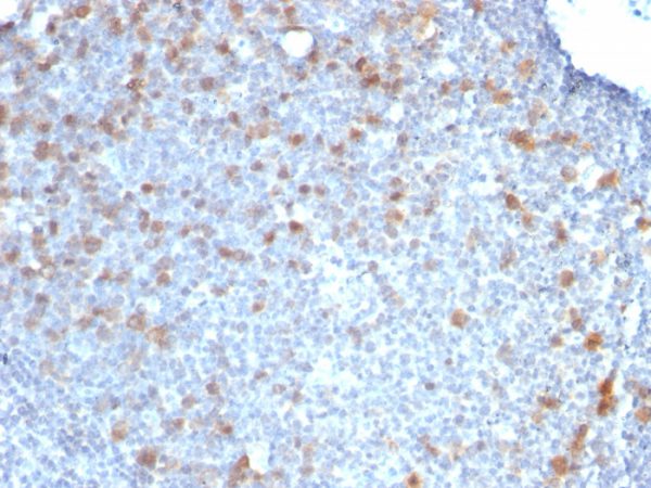 Formalin-fixed, paraffin-embedded human Tonsil stained with CDC20 Monoclonal Antibody (CDC20/1102)