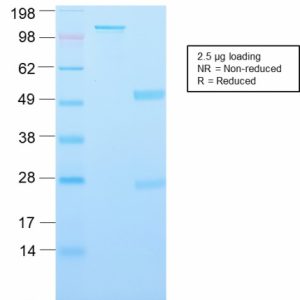 SDS-PAGE Analysis Major Vault Protein Rabbit Recombinant Monoclonal Antibody (VP2897R). Confirmation of Purity and Integrity of Antibody.
