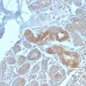 Recombinant Major Vault Protein (MVP) Antibody