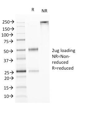 SDS-PAGE Analysis Purified TNFS15 / VEGI Monoclonal Antibody (VEGI /1283). Confirmation of Purity and Integrity of Antibody