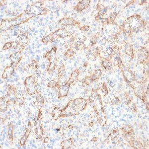 Formalin-fixed, paraffin-embedded human Spleen stained with VEGI Mouse Recombinant Monoclonal Antibody (rVEGI /1283).