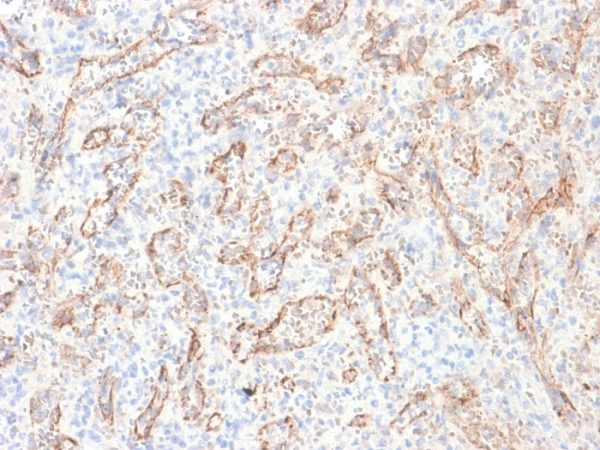 Formalin-fixed, paraffin-embedded human Spleen stained with VEGI Mouse Recombinant Monoclonal Antibody (rVEGI /1283).