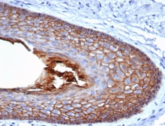 Formalin-fixed, paraffin-embedded human skin stained with E-Cadherin Mouse Monoclonal Antibody (CDH1/4585).