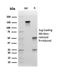 SDS-PAGE Analysis Purified E-Cadherin Mouse Monoclonal Antibody (CDH1/4585). Confirmation of Purity and Integrity of Antibody.