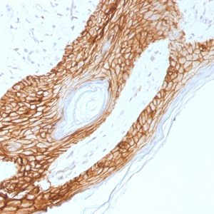 Formalin-fixed, paraffin-embedded human skin stained with E-Cadherin Mouse Monoclonal Antibody (4A2).