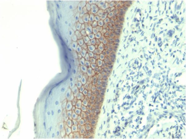 Formalin-fixed, paraffin-embedded human skin stained with E-Cadherin Mouse Monoclonal Antibody (CDH1/1525).
