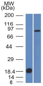 Western blot analysis of (A) recombinant protein (B) human stomach lysates. E-Cadherin Mouse Monoclonal Antibody (CDH1/1525).