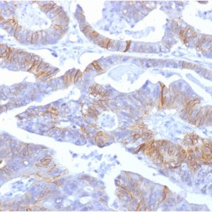 Formalin-fixed, paraffin-embedded human colon stained with E-Cadherin Mouse Monoclonal Antibody (SPM381).