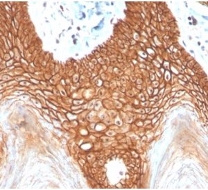 Formalin-fixed, paraffin-embedded human cervix stained with E-Cadherin Rabbit RecombinantMonoclonal Antibody (CDH1/4398R).