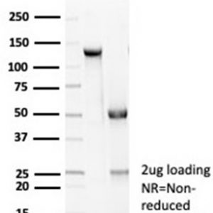 SDS-PAGE Analysis of Purified E-Cadherin Rabbit Recombinant Monoclonal Antibody (CDH1/7034R). Confirmation of Purity and Integrity of Antibody.