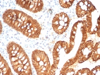 Formalin-fixed, paraffin-embedded human colon stained with E-Cadherin Rabbit Recombinant Monoclonal Antibody (CDH1/7034R). HIER: Tris/EDTA, pH9.0, 45min. 2 °: HRP-polymer, 30min. DAB, 5min.