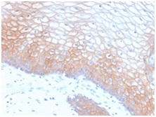 Formalin-fixed, paraffin-embedded human cervix stained with E-CadherinRabbit RecombinantMonoclonal Antibody (CDH1/2208R).