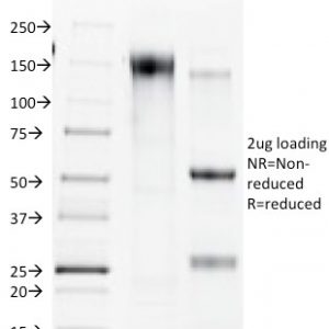 SDS-PAGE Analysis of Purified Connexin 32 Mouse Monoclonal Antibody (R5.21C). Confirmation of Purity and Integrity of Antibody.