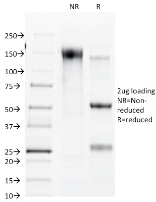 SDS-PAGE Analysis Purified Connexin 32 Mouse Monoclonal Antibody (R5.21C). Confirmation of Purity and Integrity of Antibody.