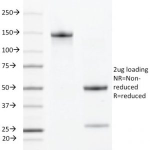 SDS-PAGE Analysis of Purified VEGFR2 Rat Monoclonal Antibody (DC101). Confirmation of Purity and Integrity of Antibody.