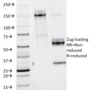 SDS-PAGE Analysis Purified Nidogen Mouse Monoclonal Antibody (ELM1). Confirmation of Purity and Integrity of Antibody.