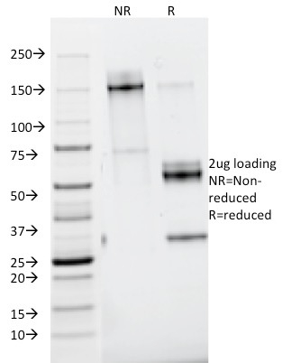 SDS-PAGE Analysis Purified Nidogen Mouse Monoclonal Antibody (ELM1). Confirmation of Purity and Integrity of Antibody.