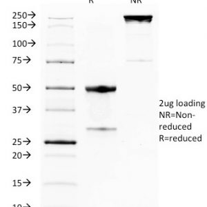 SDS-PAGE Analysis of Purified GITR Mouse Monoclonal Antibody (DTA-1). Confirmation of Purity and Integrity of Antibody.