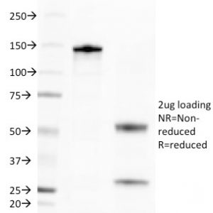 SDS-PAGE Analysis of Purified Golgi Mouse Monoclonal Antibody (371-4). Confirmation of Purity and Integrity of Antibody.