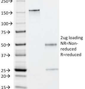 SDS-PAGE Analysis of Purified EBV Mouse Monoclonal Antibody (1108-1). Confirmation of Purity and Integrity of Antibody.