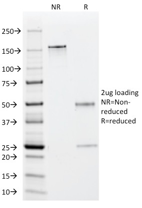 SDS-PAGE Analysis Purified EBV Mouse Monoclonal Antibody (1108-1). Confirmation of Purity and Integrity of Antibody.