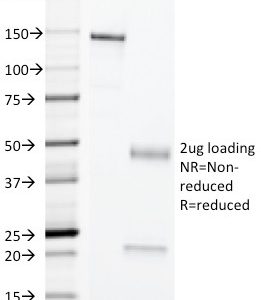 SDS-PAGE Analysis of Purified Erythrocyte Specific Mouse Monoclonal Antibody (SFL23.6). Confirmation of Purity and Integrity of Antibody.