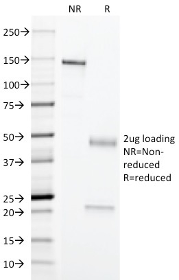 SDS-PAGE Analysis Purified Erythrocyte Specific Mouse Monoclonal Antibody (SFL23.6). Confirmation of Purity and Integrity of Antibody.
