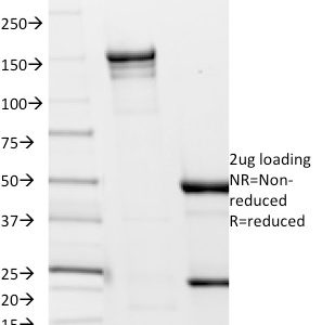 SDS-PAGE Analysis of Purified Borrelia burgdorferi (p41 Flagellin) (6802). Confirmation of Integrity and Purity of Antibody.