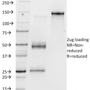 SDS-PAGE Analysis of Purified Vitronectin Receptor Mouse Monoclonal Antibody (23C6). Confirmation of Purity and Integrity of Antibody.