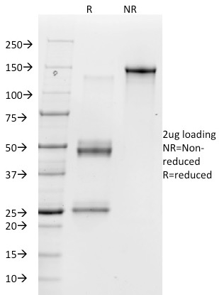SDS-PAGE Analysis Purified Vitronectin Receptor Mouse Monoclonal Antibody (23C6). Confirmation of Purity and Integrity of Antibody.