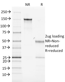 SDS-PAGE Analysis Purified MHC II Mouse Monoclonal Antibody (MK-D6). Confirmation of Purity and Integrity of Antibody.